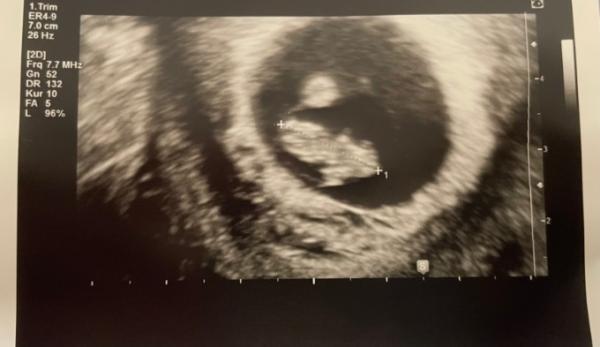 Bild zu Darf ich euch vorstellen: - Forum für November - Mamis