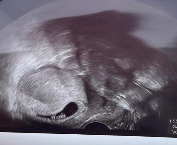 Bild zu Hallo Baby - Forum für November - Mamis