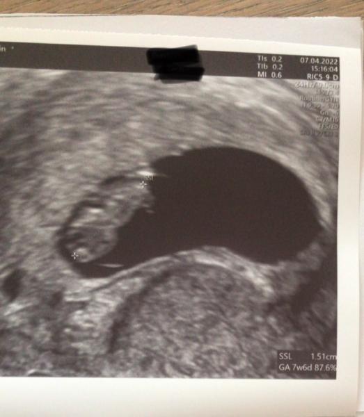Bild zu Erster Termin FA nach Kinderwunschklink - Forum für November - Mamis