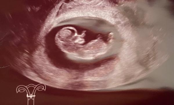 Bild zu ❤️ Hallo Wunder ❤️ - Forum für November - Mamis