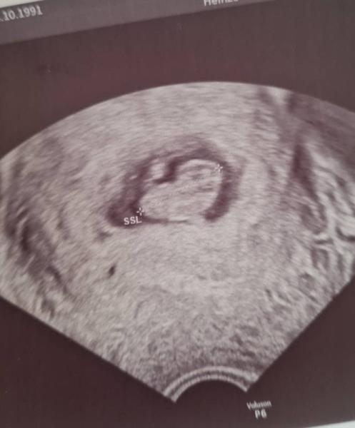 Bild zu Ramzi methode - Forum für November - Mamis