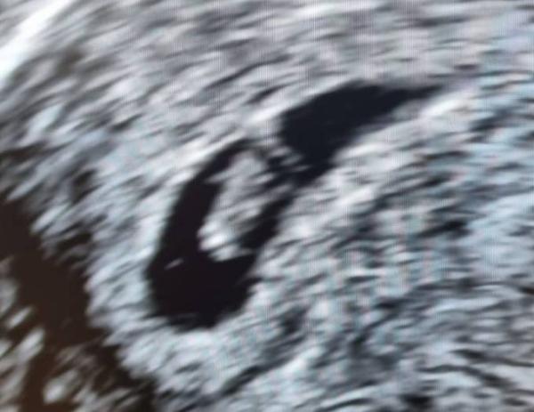 Bild zu Darf ich vorstellen? - Mein Häs'chen. - Forum für November - Mamis