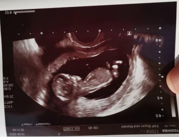Bild zu Alles perfekt 😍 - Forum für November - Mamis