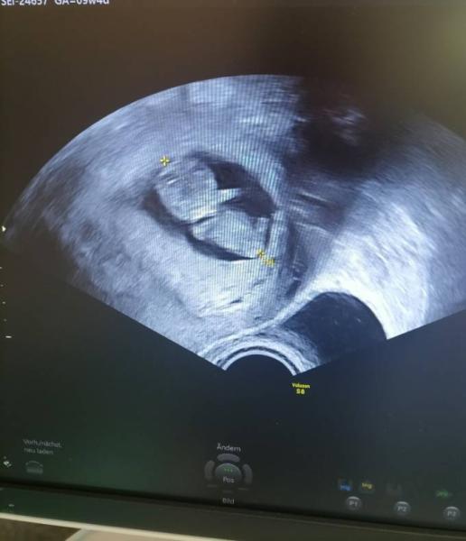 Bild zu Endlich alles wie es sein soll - Forum für November - Mamis