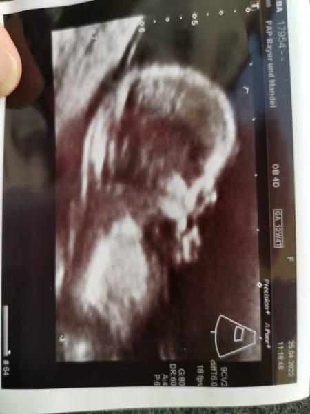 Bild zu Harmonie Test - Forum für November - Mamis