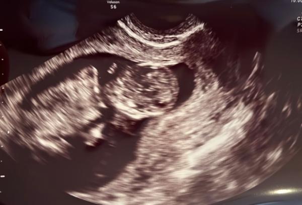 Bild zu Super Happy 😍 - Forum für November - Mamis