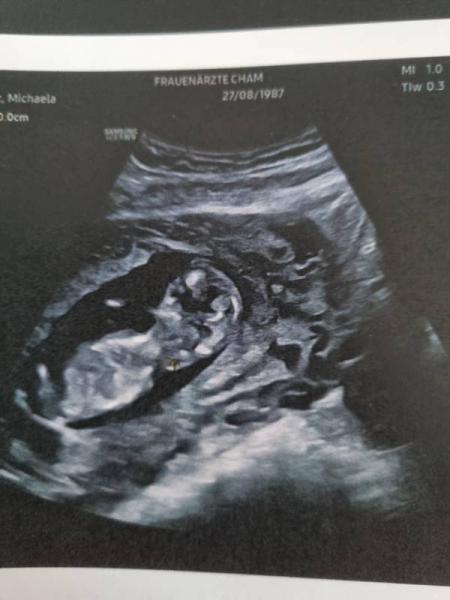 Bild zu Fa termin 😍 - Forum für November - Mamis