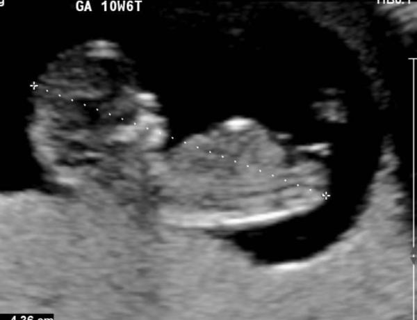 Bild zu UPDATE ♥ FA-Termin - Forum für November - Mamis