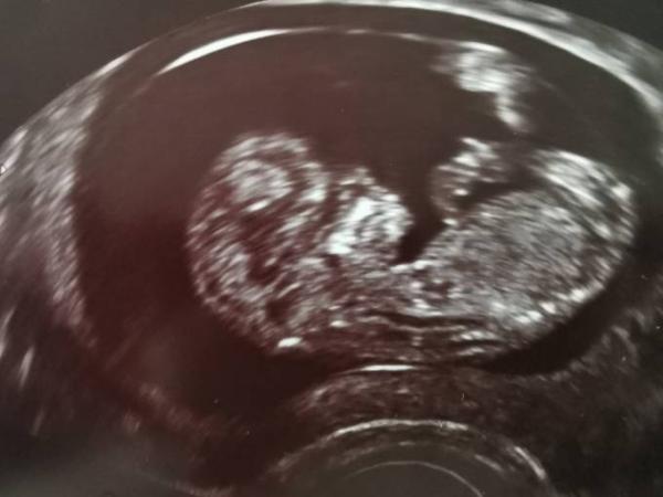 Bild zu Auch wir hatten heute wieder Termin... - Forum für November - Mamis