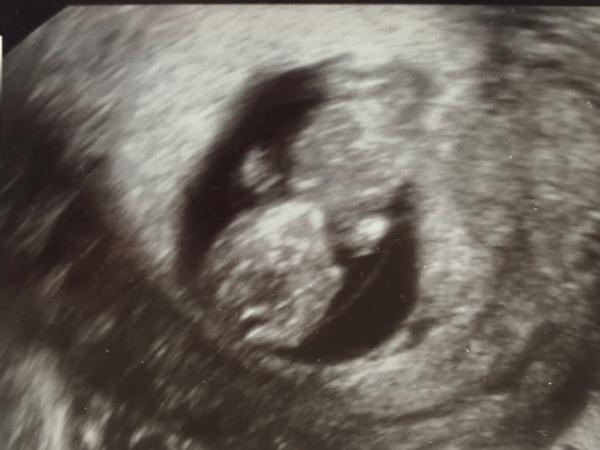 Bild zu Und schon zurück vom FA - Forum für November - Mamis