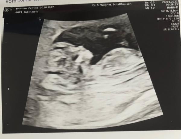 Bild zu Zweite US 🥰 - Forum für November - Mamis