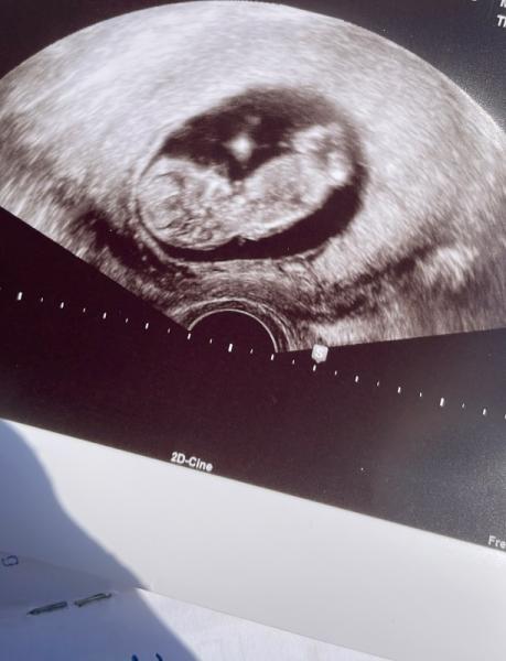 Bild zu FA Termin geschafft - Forum für November - Mamis