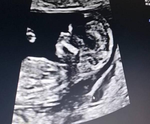 Bild zu Termin heute ❤️ - Forum für November - Mamis
