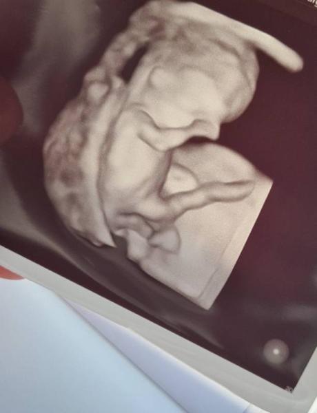 Bild zu Baby TV - Forum für November - Mamis
