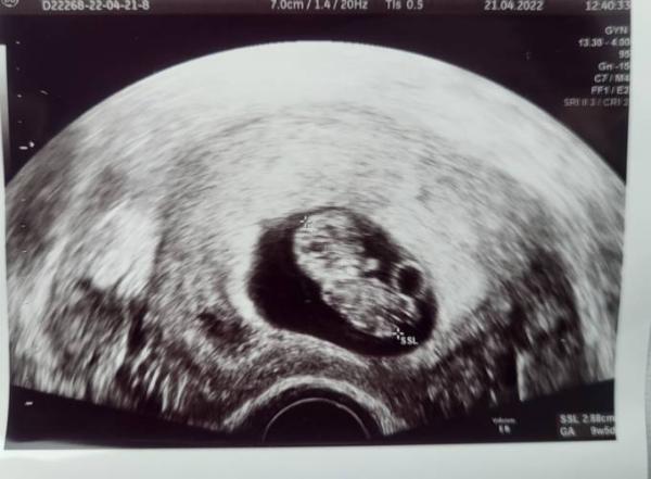 Bild zu Mädchen oder Junge ? - Forum für November - Mamis