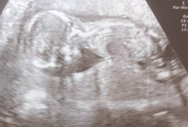 Bild zu Vom FA zurück - Forum für November - Mamis