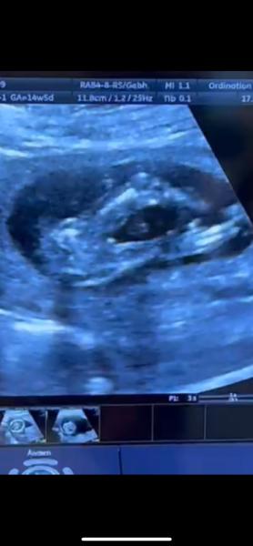 Bild zu Geschlecht Outing - Forum für November - Mamis