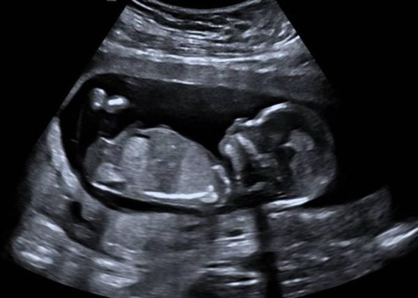 Bild zu In mir wohnt ... - Forum für November - Mamis