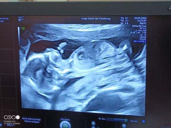 Bild zu Lange Nacht der Forschung - Spontanultraschall - Forum für November - Mamis