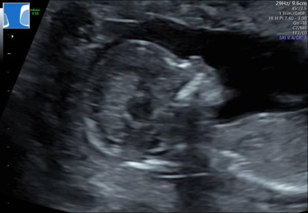 Bild zu In mir wohnt ... - Forum für November - Mamis