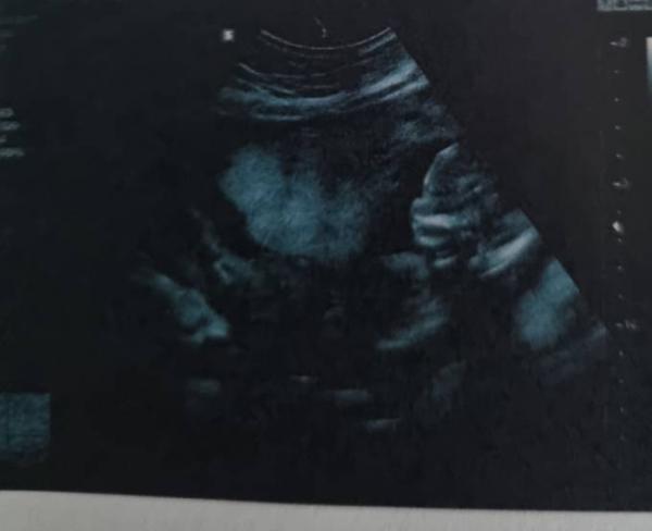 Bild zu Fa termin gehabt 🥰 - Forum für November - Mamis