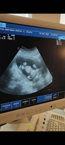 Bild zu Gyn-Termin heute - Forum für November - Mamis