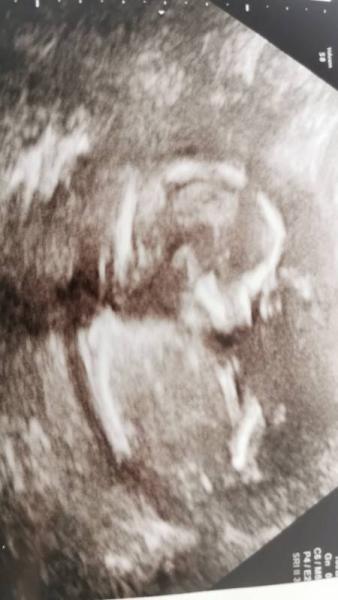 Bild zu Babycheck erledigt :D - Forum für November - Mamis