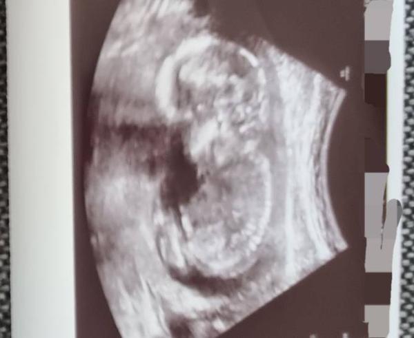 Bild zu Wer hat auch so schöne Bilder - Forum für November - Mamis