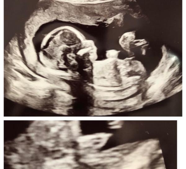 Bild zu Heutiger Termin - Forum für November - Mamis