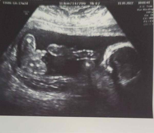 Bild zu Wir bekommen..... - Forum für November - Mamis