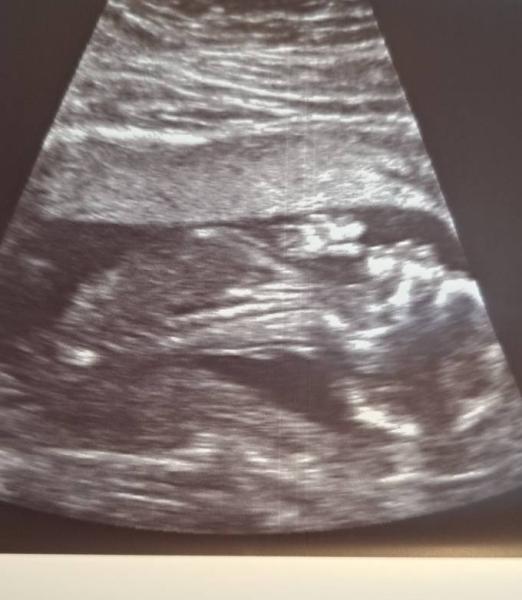 Bild zu Heute Harmony Test gemacht! - Forum für November - Mamis