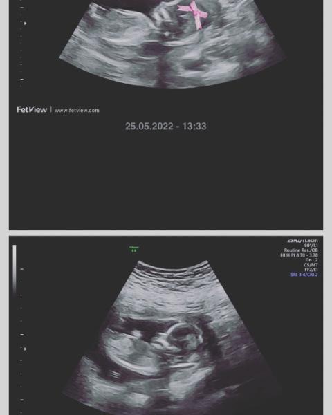 Bild zu Harmony Test und US Outing - Forum für November - Mamis