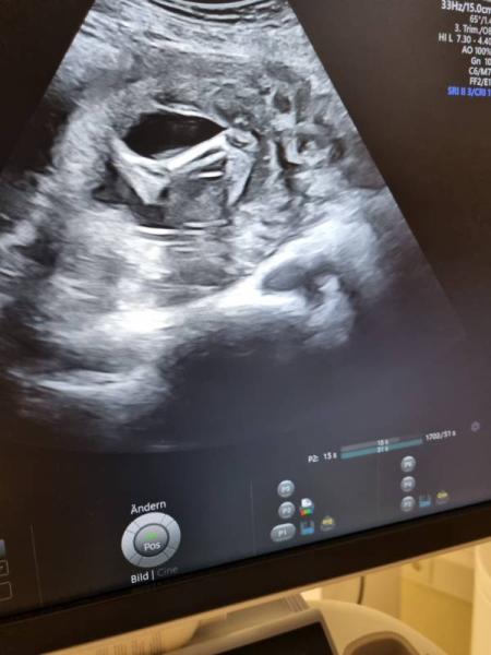 Bild zu Wir sind fertig - Forum für November - Mamis