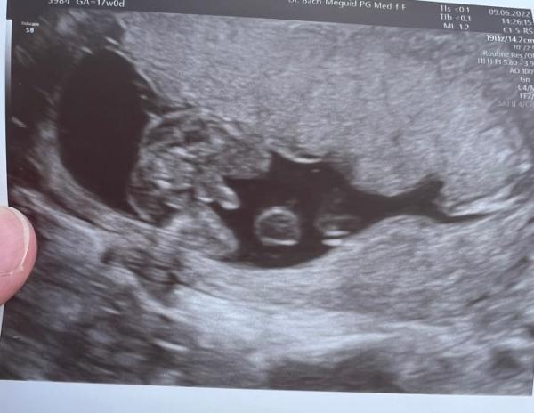 Bild zu Sieht es für euch aus wie ein Junge? - Forum für November - Mamis