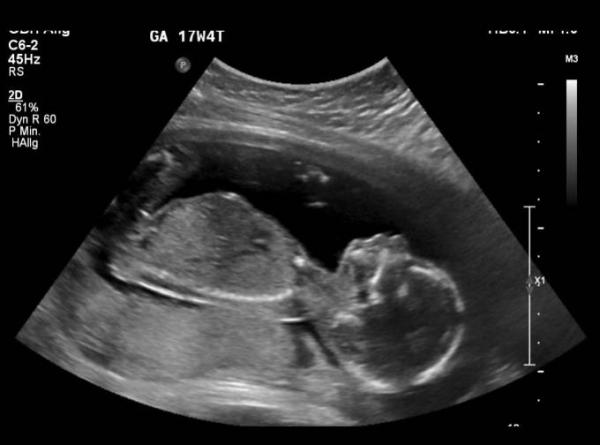 Bild zu Ich bin schon ganz groß 👶 - Forum für November - Mamis