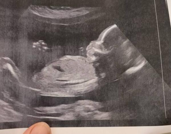 Bild zu Endlich wieder Baby gesehen 😍😍😍 - Forum für November - Mamis