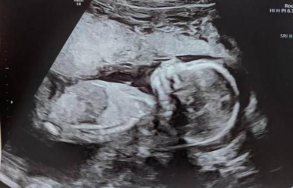 Bild zu Meeting mit Baby :) - Forum für November - Mamis