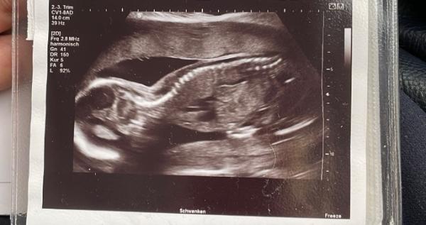 Bild zu FA Termin geschafft - Forum für November - Mamis