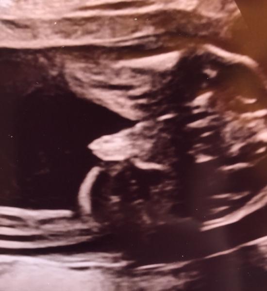 Bild zu Zweiter grosser US …. und Outing 👧👦 - Forum für November - Mamis