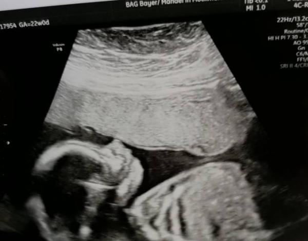Bild zu Endlich war der lang ersehnte FA Termin - Forum für November - Mamis