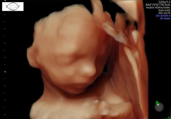 Bild zu Zeigt her eure mäuse - Forum für November - Mamis