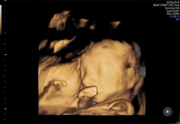 Bild zu Organscreening - Forum für November - Mamis