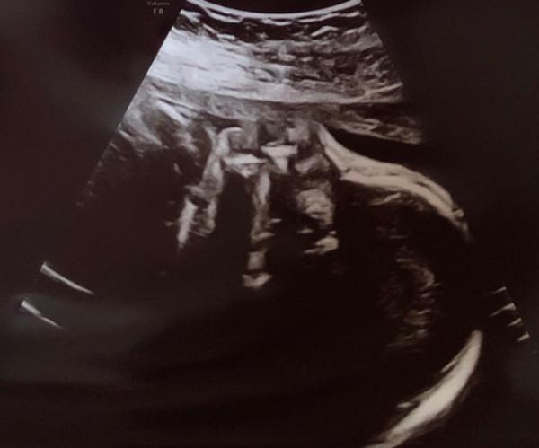 Bild zu Termin gehabt… - Forum für November - Mamis