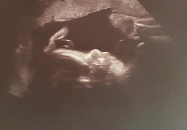 Bild zu Update von unserem Baby Boy 💙 - Forum für November - Mamis