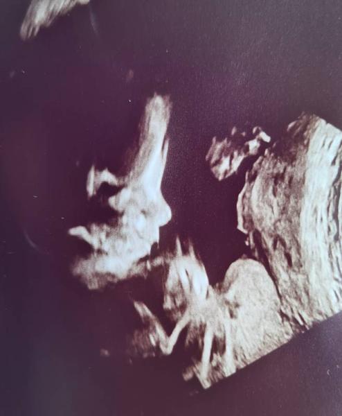 Bild zu Update SSW27+0 - Corona gut überstanden - Forum für November - Mamis