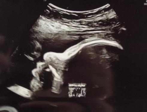 Bild zu Baby TV - Forum für November - Mamis