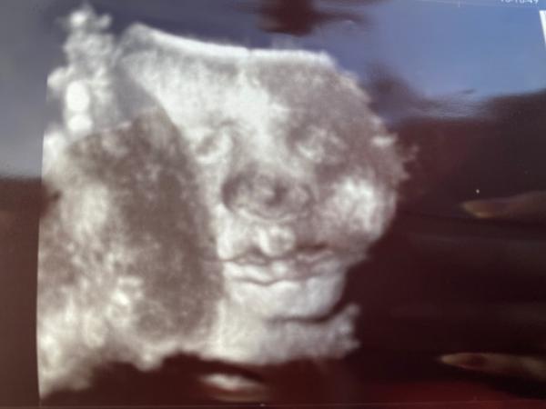 Bild zu Kontrolltermin, erstes CTG & Elternabend der Klinik - Forum für November - Mamis