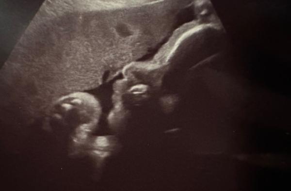 Bild zu Alle Zweifel beseitigt 😍💙 - Forum für November - Mamis