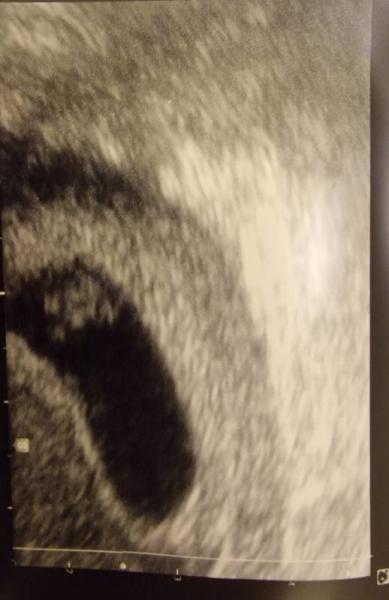 Bild zu Zurück vom ersten Termin - Forum für November - Mamis