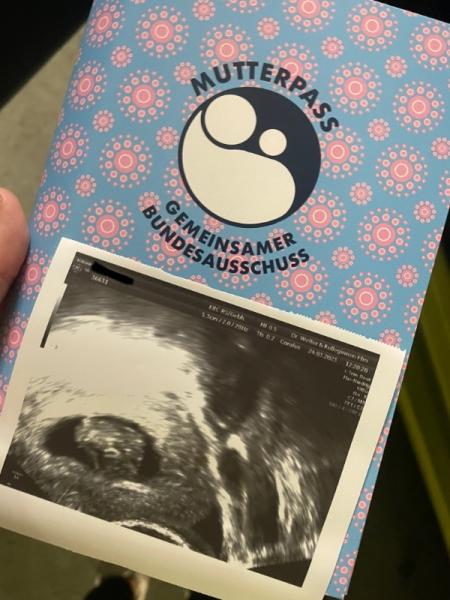 Bild zu Schlechtes Ultraschallbild - Forum für November - Mamis